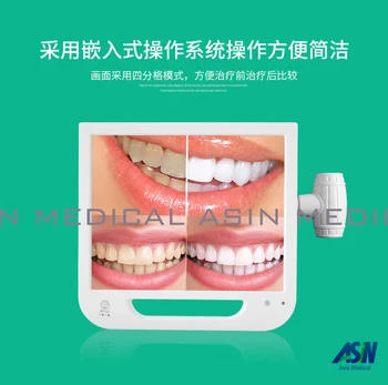 17 colių LCD monitorius, dantų endoskopą (USB / AV / TV / HDMI / VGA) + Vidinė ketvirtį grotelėmis + intraoral vaizdo kamera + nuotolinio valdymo pultas