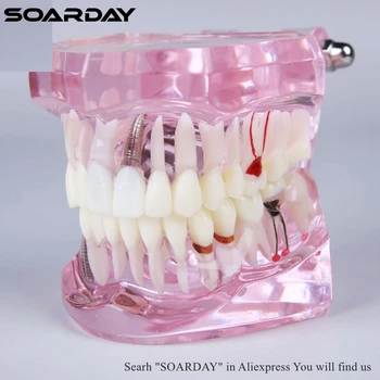 SOARDAY 1pc Dantų Išsamią Mokymo Modelį Dantų Ligas ir dantų Protezavimas