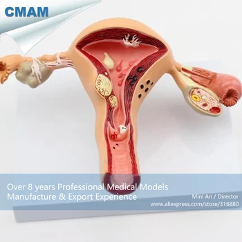 12441 CMAM-ANATOMY03 Gyvenimo Dydis Moterų Gimdos Anatomija Modelis Rodo, Bendrosios Patologijos,Anatomijos Modeliai > Nėštumo Modeliai