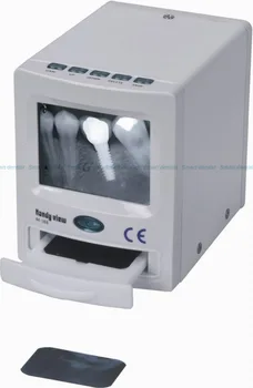 Dantų rentgeno spinduliuotės Kino Žiūrovas Skaitytuvas Reader vaizdo 2.5 colių LCD VAIZDO SD kortelę