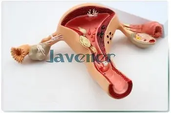 Ginekologija Anatomijos Moterų Lytinių Organų Anatomija Medicininės Patologijos Modelis