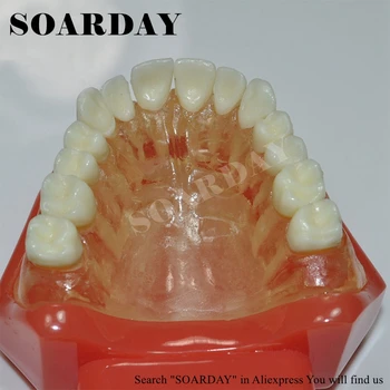 SOARDAY Standartas Dantų Modelio Dantų Išimami Dantų Mokymo Komunikacijos Modelis