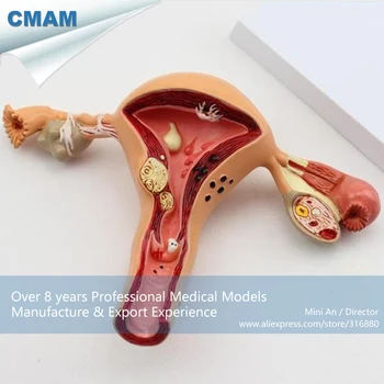 12441 CMAM-ANATOMY03 Gyvenimo Dydis Moterų Gimdos Anatomija Modelis Rodo, Bendrosios Patologijos,Anatomijos Modeliai > Nėštumo Modeliai